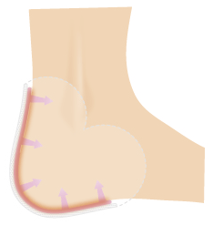 Pedi-Soothe diagram